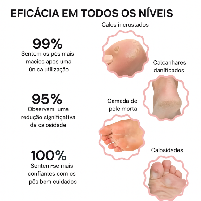 O essencial para pés suaves - Kit de beleza para pés